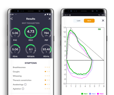 Two phones side-by-side showing different spirometry test results using the Spirobank App.